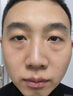 歐誘眼袋霜去大眼袋嚴重中老年專(zhuān)用消除重度男女士眼袋祛去除神器貼膜 消腫液第一名 提拉緊致抗皺淡化黑眼圈最好的眼霜 曬單實(shí)拍圖