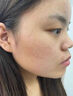 FLYMAN點(diǎn)痣膏水疤痕修復去痣點(diǎn)痣膏點(diǎn)疣水醫用專(zhuān)用(非藥)官方正品祛痣膏 套裝一:【點(diǎn)痣+修復】一盒 痣準掉 祛斑潤膚美容院專(zhuān)用臉部不留疤不留坑 曬單實(shí)拍圖