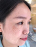YYTISS377祛斑美白淡斑淡化黑色素藥霜黃褐斑雀斑曬斑女煙酰胺男士專(zhuān)用 曬單實(shí)拍圖