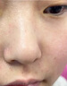 康佳（KONKA）黑頭吸出器吸黑頭儀器清理神器面部小氣泡清潔美容儀男女士毛孔粉刺清潔器生日禮物送男女友 全配款-小氣泡清潔儀+精華水+氣泡水+6種吸頭 曬單實(shí)拍圖