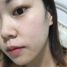 同仁堂（TRT）祛痘膏去痘痘和痘印痘坑初高中生男女學(xué)生粉刺青春痘淡化痘印20g 曬單實(shí)拍圖