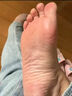 腳氣藥止癢脫皮爛腳丫去真菌感染根藥治腳氣止癢脫皮爛腳起小水泡特新效藥腳爛腳趾縫癢潰爛專(zhuān)用藥克霉唑乳膏 2盒乳膏+2盒噴劑【搭配使用 效果翻倍】一步到位 曬單實(shí)拍圖