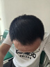 【固生雙效發(fā)量套裝】蔓迪生發(fā)泡沫60g*3瓶+蔓迪防脫固發(fā)洗發(fā)水200g（第二代米諾地爾+烏諾地爾 雙效固生） 曬單實拍圖