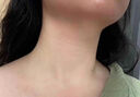 千紹方脖子黑色素沉淀去除治黑棘皮癥藥膏男女胖胳膊肘腋下去黑色素神器 單瓶裝【去黑色素沉淀專用】 曬單實(shí)拍圖