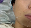 布衣世慈重組III型人源化膠原蛋白敷貼敷料美容術(shù)后修護創(chuàng  )面愈合緩解紅敏 4盒裝（共20貼） 曬單實(shí)拍圖