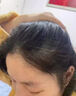 茜妃生發(fā)液激活毛囊防脫生發(fā)增發(fā)密發(fā)長(cháng)發(fā)劑中藥洗發(fā)水育發(fā)濃密增長(cháng)液 特效一盒裝【當晚生發(fā)】 生姜養發(fā)固發(fā)嚴重男女士專(zhuān)用米諾 曬單實(shí)拍圖