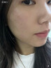 夫抗組合夫抗凈顏素和夫抗膚清凈噴霧臉額痤痘閉刺夫抗凈顏素正品直售 凈顏素1盒+膚清凈1盒）輕度 曬單實拍圖