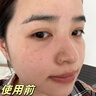 美顏坊氨甲環(huán)酸精華液5%傳明酸非院I線可濕敷淡化色沉 曬單實拍圖