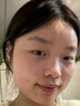 華美科醫用重組人體表皮生長(cháng)因子點(diǎn)痣疤痕修復凝膠燙軟膏傷口愈合15g1支 曬單實(shí)拍圖