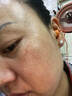 LA美國377祛斑霜美白淡化老年黃褐雀斑黑色素女男士護膚品去曬提亮 曬單實(shí)拍圖