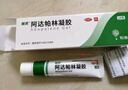 麗芙阿達帕林凝膠35g/盒第三代維a酸乳膏醫用祛痘印修復淡化痘印痘坑修復祛痘藥膏去黑頭收縮毛孔粗大修復 曬單實(shí)拍圖