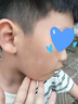 白色糠疹兒童用藥臉上長(zhǎng)白斑花斑體癬皮膚真菌感染維生素e乳膏藥 1盒【白色糠疹專用膏】 曬單實(shí)拍圖