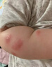 Masata新加坡進(jìn)口紫草膏蚊蟲叮咬止癢消腫青草膏基孔肯雅熱驅(qū)蚊露50ml 曬單實拍圖