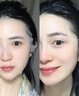 OHBT黃芪面膜10片抗皺緊致抗衰老補水熬夜美白淡斑女男士金榜第1名 曬單實拍圖