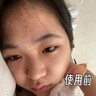 茵倩377美白面膜補水保濕淡斑去黃氣提亮暗沉緊致抗皺紋抗老面膜正品 持證美白/祛斑/祛黃【30片】 曬單實(shí)拍圖