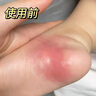 廾卜制藥蚊蟲叮咬止癢消腫嬰幼兒童滾珠型戶外止癢抑菌皮膚瘙癢身體癢神器 曬單實(shí)拍圖