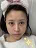 山本星奈眼霜淡化細紋提拉緊致黑眼圈重度去除祛男女士熬夜黑色素專(zhuān)用的藥 單盒裝【快速去黑眼圈】 曬單實(shí)拍圖