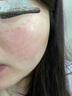普門科技醫(yī)用大排燈美容儀紅藍(lán)黃光治療敏感肌痘痘痤瘡消炎七夕禮物送女友 光E【三光+12模式】 曬單實(shí)拍圖