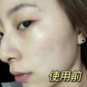美白祛斑抗皺霜煙酰胺淡化雀斑黑色素提亮膚色補水保濕滋潤護膚品 貝玲美美白祛斑【1盒】 曬單實(shí)拍圖