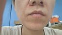 dr.arrivo宙斯三代家用美容儀器 微電流變頻 面部提拉緊致臉部 送女朋友 七夕情人節(jié)禮物 曬單實拍圖