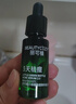 麗可植【官方直售店】小綠瓶祛痘精華液黑頭去抗痘痘印收縮毛孔護膚品 【兩瓶】2.0祛痘加強版+慕斯1瓶 曬單實拍圖