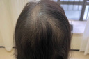 儒意防脫育發(fā)洗發(fā)水生姜側柏葉固發(fā)去屑止癢男女士洗頭膏露金榜第1名 曬單實(shí)拍圖