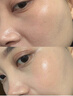 維特絲377面霜乳液男女士美白淡斑保濕補水去黃提亮淡黑色素兒童護膚品 曬單實(shí)拍圖