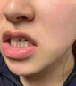 白之選牙疼消炎牙齦腫痛牙膏蟲(chóng)牙蛀牙齒痛出血修復(fù)殺死神經(jīng)專(zhuān)用的牙膏 特效【修復(fù)牙損傷一盒裝】 曬單實(shí)拍圖