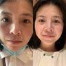 江中葡萄籽維生素E膠囊淡斑內(nèi)調(diào)去黃褐斑美白提亮去黃改善暗沉膚色3瓶 曬單實(shí)拍圖