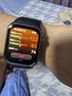 華為（HUAWEI）手表WATCH D2【咨詢享優(yōu)惠】腕部心電血壓采集記錄儀家用血氧睡眠壓力體溫監(jiān)測運動健康家人禮物 幻夜黑【送保護(hù)膜+曬單十選一】 曬單實拍圖