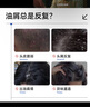 滿(mǎn)婷（MANTING）氨基酸控油去屑洗發(fā)乳450ml男女青花椒舒緩去油清爽蓬松洗發(fā)水液 氨基酸控油去屑洗發(fā)水450ml1瓶 曬單實(shí)拍圖