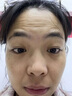 EDRI川字紋貼抬頭紋去除神器男重度額頭皺紋睡覺(jué)貼提拉緊致抗皺女專(zhuān)用 曬單實(shí)拍圖