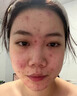 Anypay多囊卵巢綜合征肌醇多囊備孕調(diào)理月經(jīng)內(nèi)分泌女性補(bǔ)充雌激素 1瓶裝【不劃算 多買實(shí)惠】 曬單實(shí)拍圖