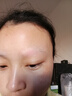 邦臣（BANGCHEN）308白癜風(fēng)治療儀光療儀醫院紫外線(xiàn)燈同款家用銀屑病窄譜nbuvb激光 【強度20/面積3 】基礎款UV308A1 曬單實(shí)拍圖
