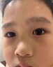 御夫清美國進(jìn)口疤克巴克祛疤膏兒童去疤痕修復凝膠小孩專(zhuān)用除去疤膏手術(shù) 曬單實(shí)拍圖