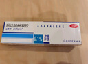 【原研好藥】達芙文 阿達帕林凝膠0.1%*30g*2盒用于以粉刺丘疹和膿皰為主要表現(xiàn)的輕中度尋常型痤瘡 曬單實拍圖