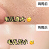 維特絲（vetes）去角質(zhì)面部啫喱控油保濕洗面奶男女士清潔毛孔黑頭閉口溫沒激素和 【6大專利】果酸去角質(zhì)啫喱200g 曬單實拍圖