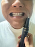 康佳超聲波潔牙器洗牙器結石去清除潔洗牙齒沖洗器去黃牙結石神清潔器煙漬茶漬工具醫用七夕情人節禮物 星空藍95%選擇【真超聲波醫療器械認證】 4支噴頭 曬單實(shí)拍圖