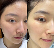 Losoki瑞士進(jìn)口377面膜美白補水淡斑提亮膚色女男士抗皺緊致抗衰老熬夜 曬單實(shí)拍圖