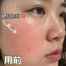 焦博士日本曬后修復面膜修復敏感皮膚屏障受損泛紅醫美用防曬傷急救白 曬單實(shí)拍圖