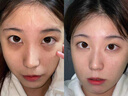 透真咖啡因60g眼霜淡化細(xì)紋提拉緊致黑眼圈男女玻色因抗皺提亮淡眼袋 曬單實(shí)拍圖