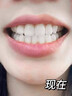 CNDK牙齒炫白牙斑凈洗牙液去黑牙黃牙煙牙白牙美潔牙粉口氣清新洗牙粉 三盒 曬單實(shí)拍圖