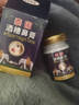 克頓默奧酒糟鼻草莓鼻紅腫玫瑰痤瘡紅鼻子專(zhuān)用去粉刺黑頭紅血絲螨蟲(chóng)修護軟 三盒周期裝（中度型） 搭紅鼻子酒糟鼻頭紅腫產(chǎn)品用 曬單實(shí)拍圖