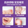 貝因美紫草油嬰兒專用紅屁屁私處可用新生兒童按摩護(hù)膚油淹脖子護(hù)臀膏 曬單實(shí)拍圖