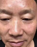 胎記去除膏神器去胎記臉部黑色素太田咖啡斑淡化老年黃褐雀斑紅胎記遺傳胎記全身胎記祛除膏 單盒裝 曬單實拍圖