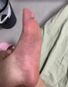 達(dá)克寧腳氣藥止癢脫皮爛腳丫真菌感染治腳氣達(dá)克寧硝酸咪康唑乳膏腳臭腳氣藥止癢真菌感染皮膚用藥 非處方藥 2盒【硝酸咪康唑乳膏】癢的受不了 老是摳腳 達(dá)克寧腳氣藥止癢脫皮爛腳丫真菌感染治腳氣 曬單實(shí)拍圖