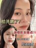 EXPRESSIONS進口除螨蟲祛痘氨基酸洗面奶控油男女士去黑頭縮毛孔潔面乳200g 曬單實拍圖