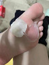 老繭軟化膏繭子去除器腳底厚繭死皮腳趾關(guān)節繭軟化劑腳后跟硬皮 買(mǎi)3送2【鞏固裝】500%包掉繭 去腳底老繭去硬皮去老繭神器進(jìn)口 曬單實(shí)拍圖