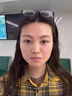 dyey點(diǎn)痣膏無(wú)痕去痣黑痣瘊子點(diǎn)痣液扁平尤絲狀尤尖尤肉刺肉兒童可用 曬單實(shí)拍圖