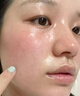 韓方五谷蘆薈膠舒緩凝膠面霜曬后修護褪紅補水保濕祛痘淡化疤痕乳液男女士 曬單實拍圖